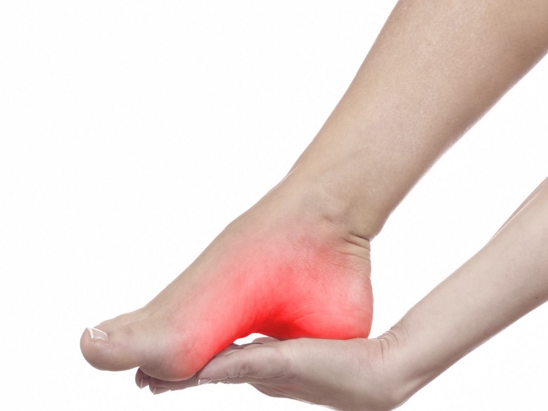 Fascite Plantar