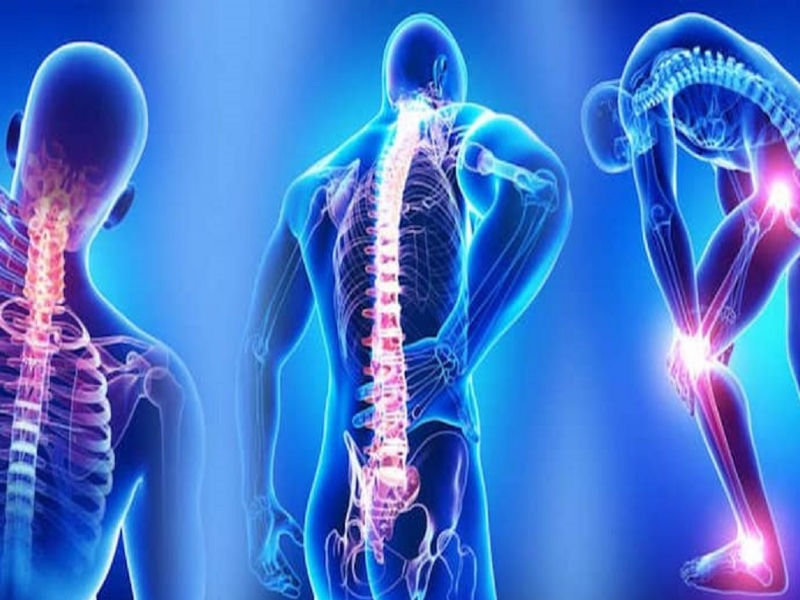 Fibromialgia